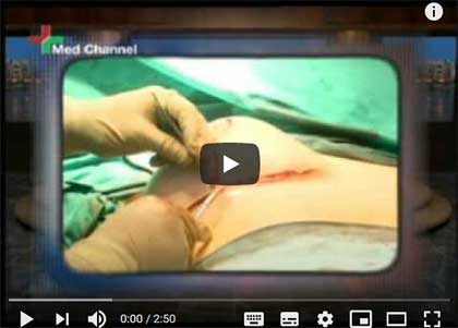 пластической хирургии