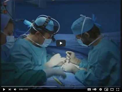 РИНОПЛАСТИКА – ПЛАСТИКА ПЕРЕГОРОДКИ НОСА