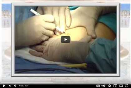 пластической хирургии