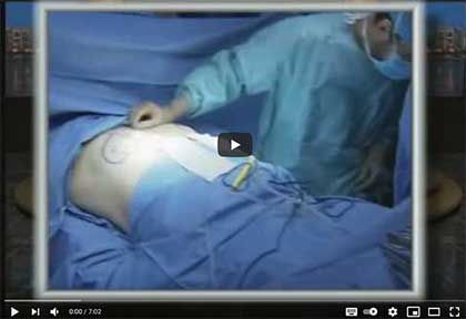 пластической хирургии