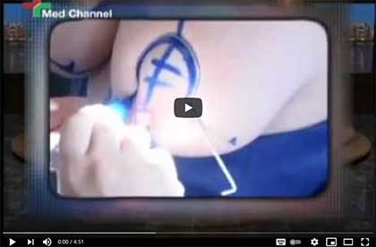 пластической хирургии